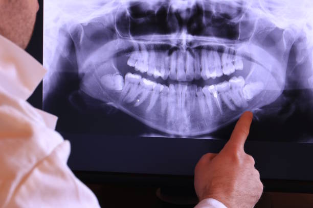 Best Emergency Root Canal Treatment in Piedmont, OK