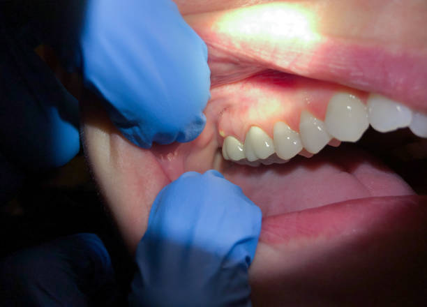 Best Emergency Dentist for Special Needs Patients in Piedmont, OK
