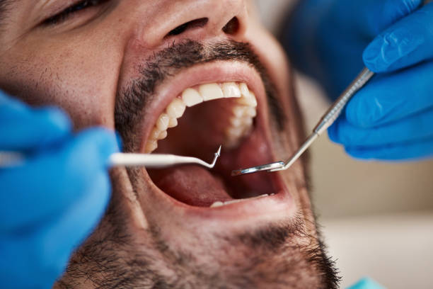 Best Emergency Dentist for Knocked-Out Tooth in Piedmont, OK