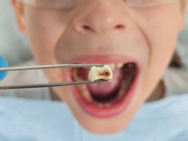 Best Emergency Dental Services for Seniors in Piedmont, OK