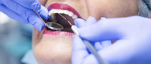 Best Emergency Dental Extractions in Piedmont, OK